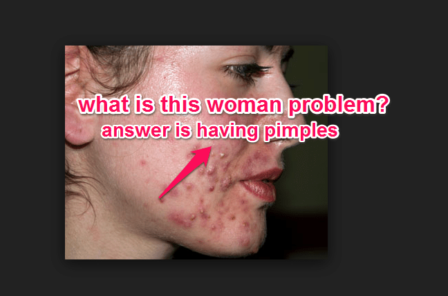woman with pimples